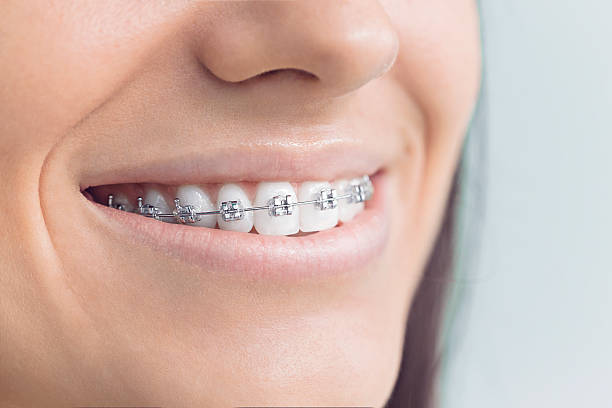Best Full Mouth Reconstruction  in Charlotte Hall, MD